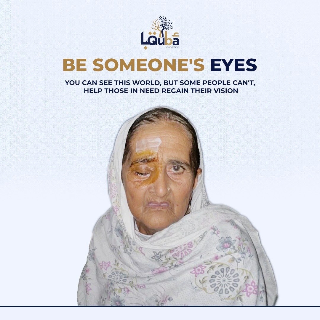 Eye surgery donation